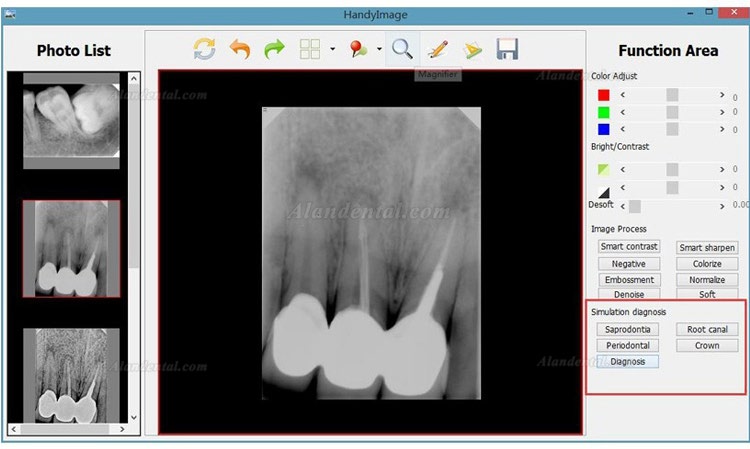 High Resolution Digital USB Type Dental X Ray Sensor Rvg